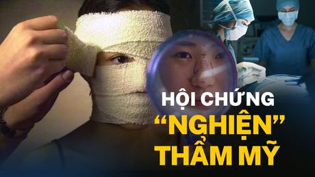 Hội chứng 'Nghiện' thẩm mỹ